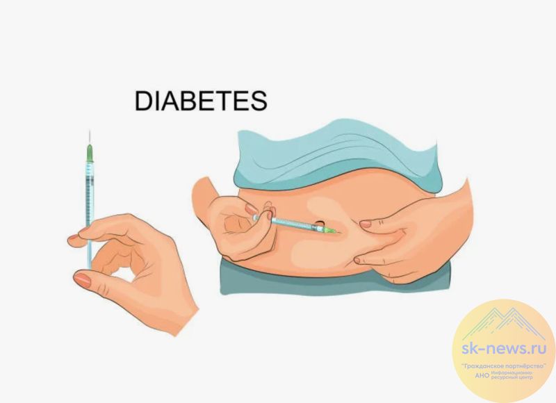 Инсулин для тысяч пациентов: Ставропольский край закупил жизненно важный препарат на 115 млн рублей